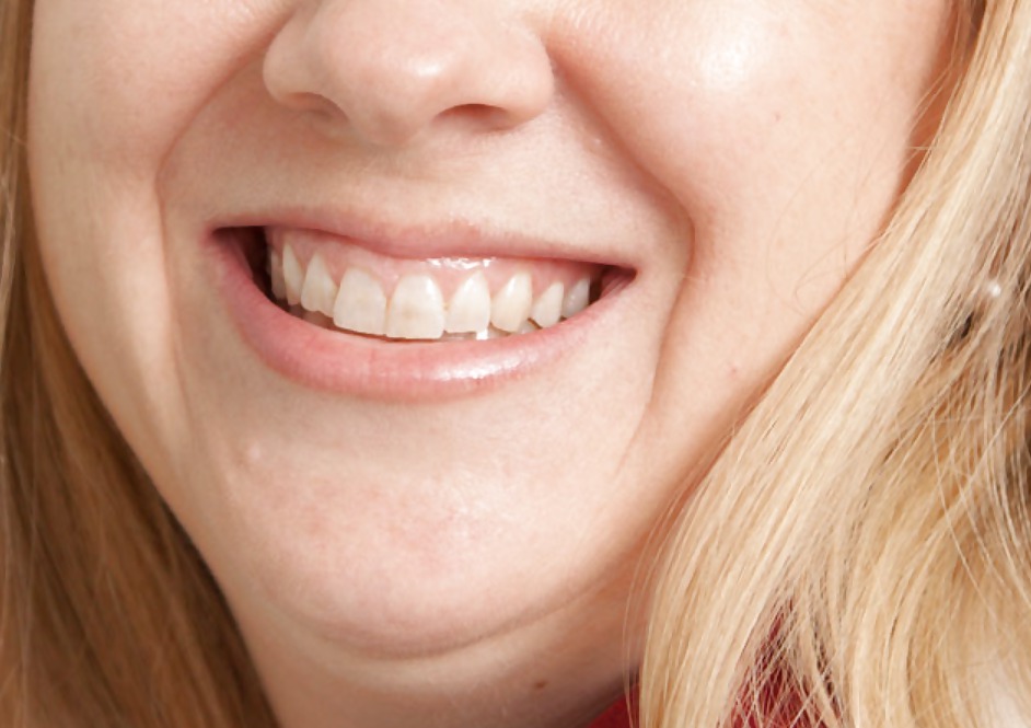 La bocca femminile
 #6581768