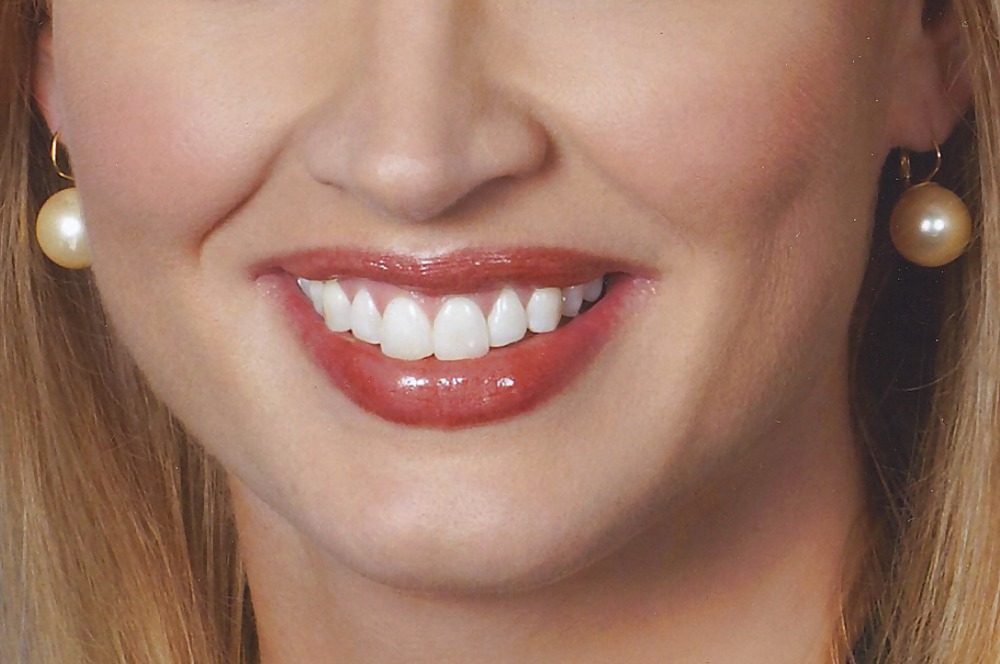 La bocca femminile
 #6582256