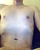 See me #10332678