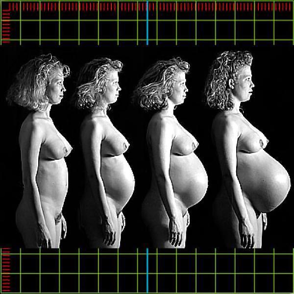 Antes y después - embarazada
 #16060574
