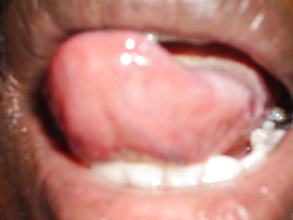 MY MOUTH #3680000