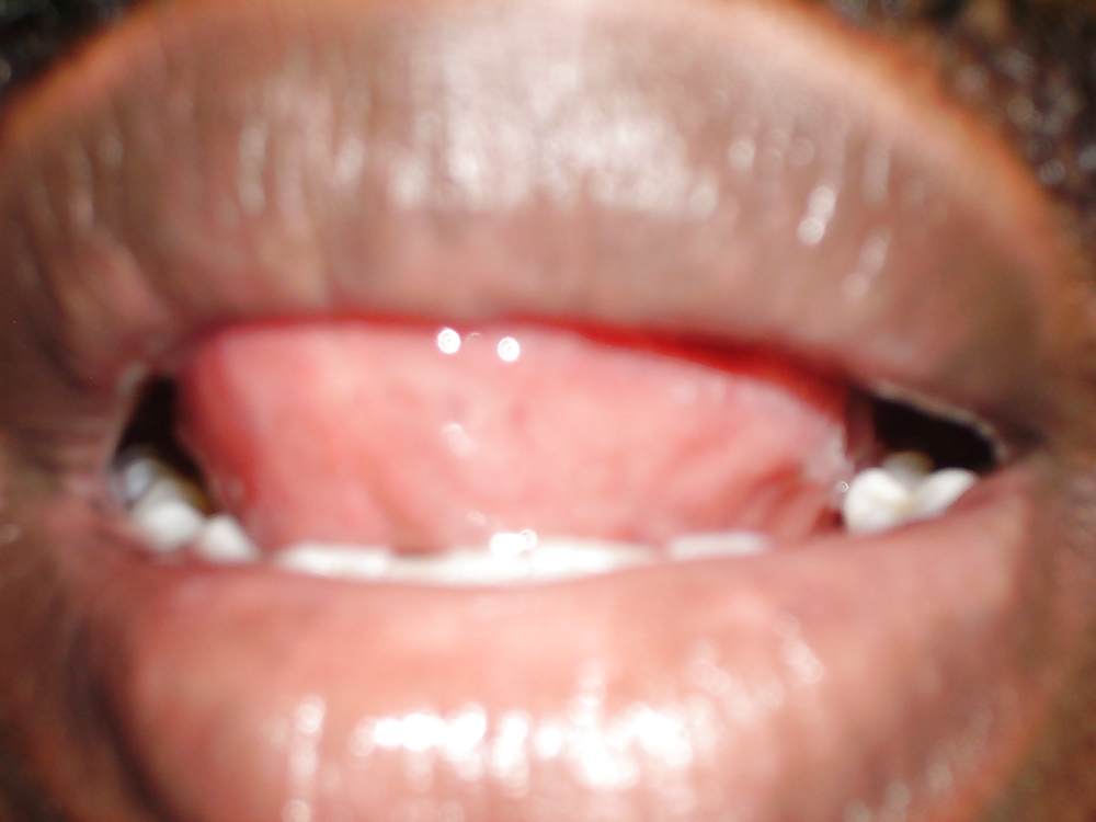 MY MOUTH #3680026