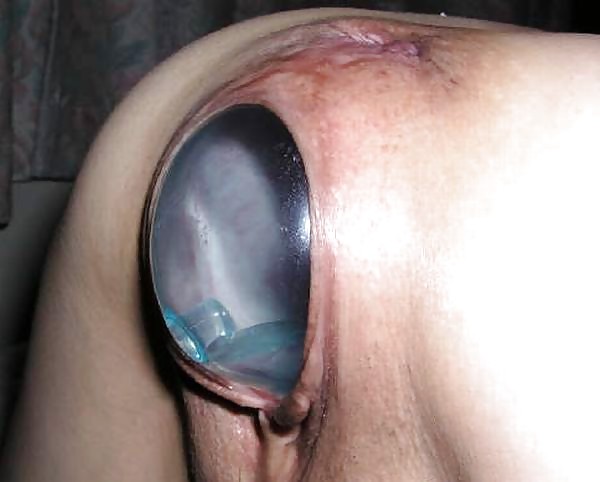 Good Insertions #8895313