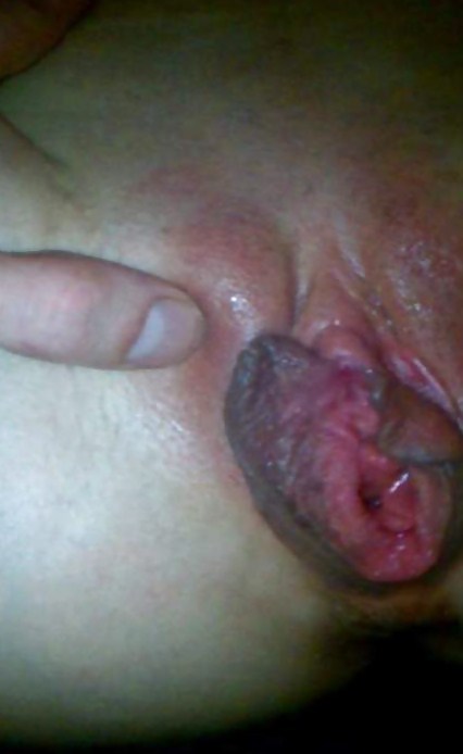 MY DIRTY OPENED LABIA AFTER GANGBANG WITH 35 STUDS #11659443