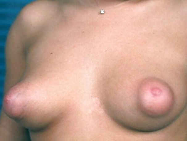 Some nice nipples