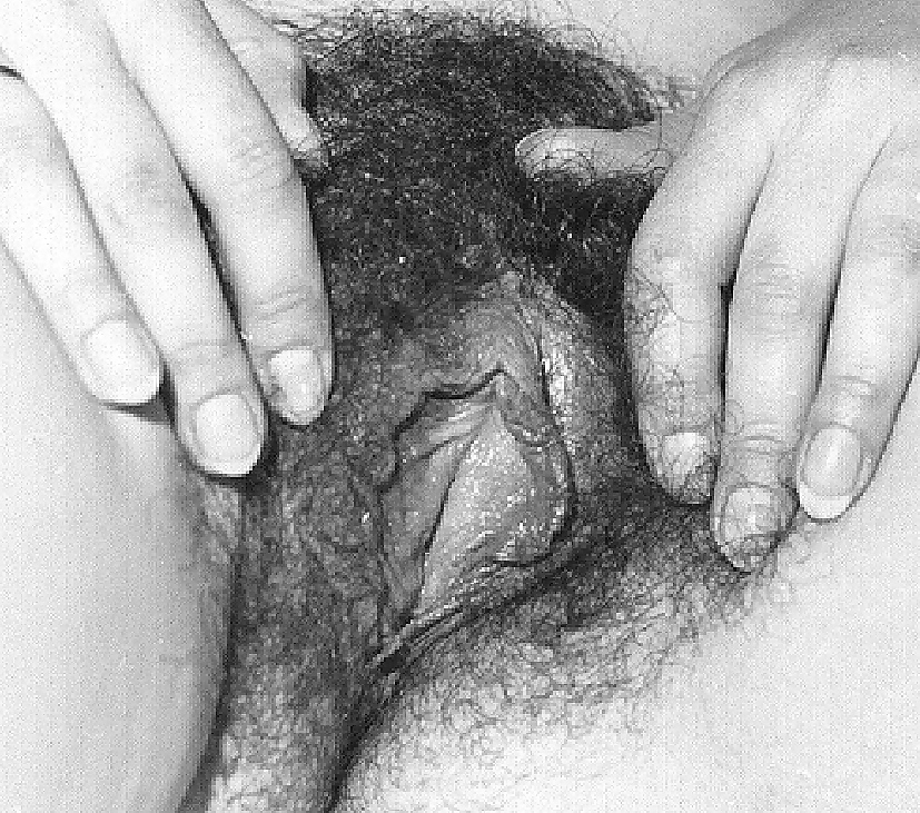 Some bw photos of hairy woman #3174055