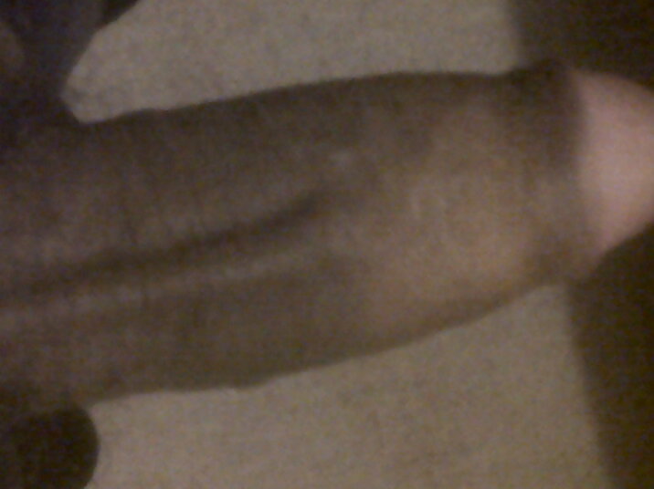 More of mee #8881210