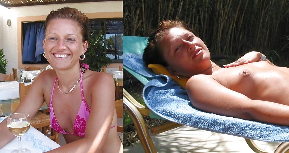 Before after 337. #3672913