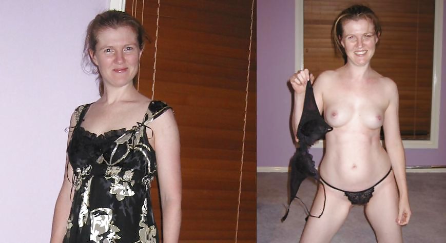 Before after 337. #3672919