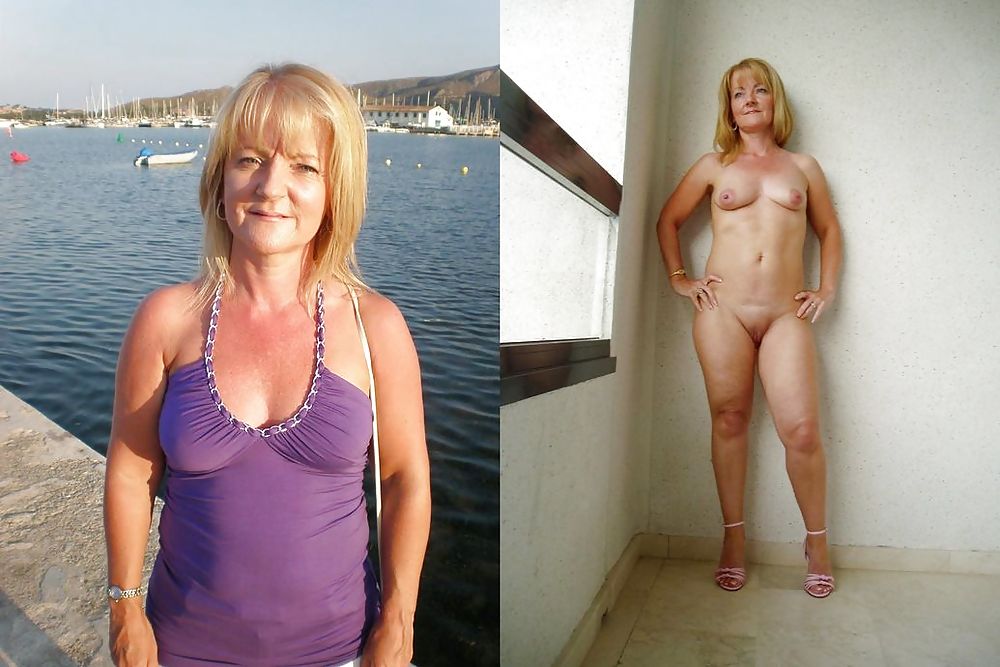 Before After 32 #2021086