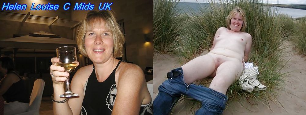 Before After 32 #2021148