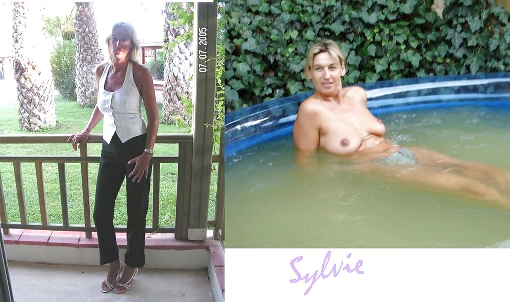 Before After 32 #2021164