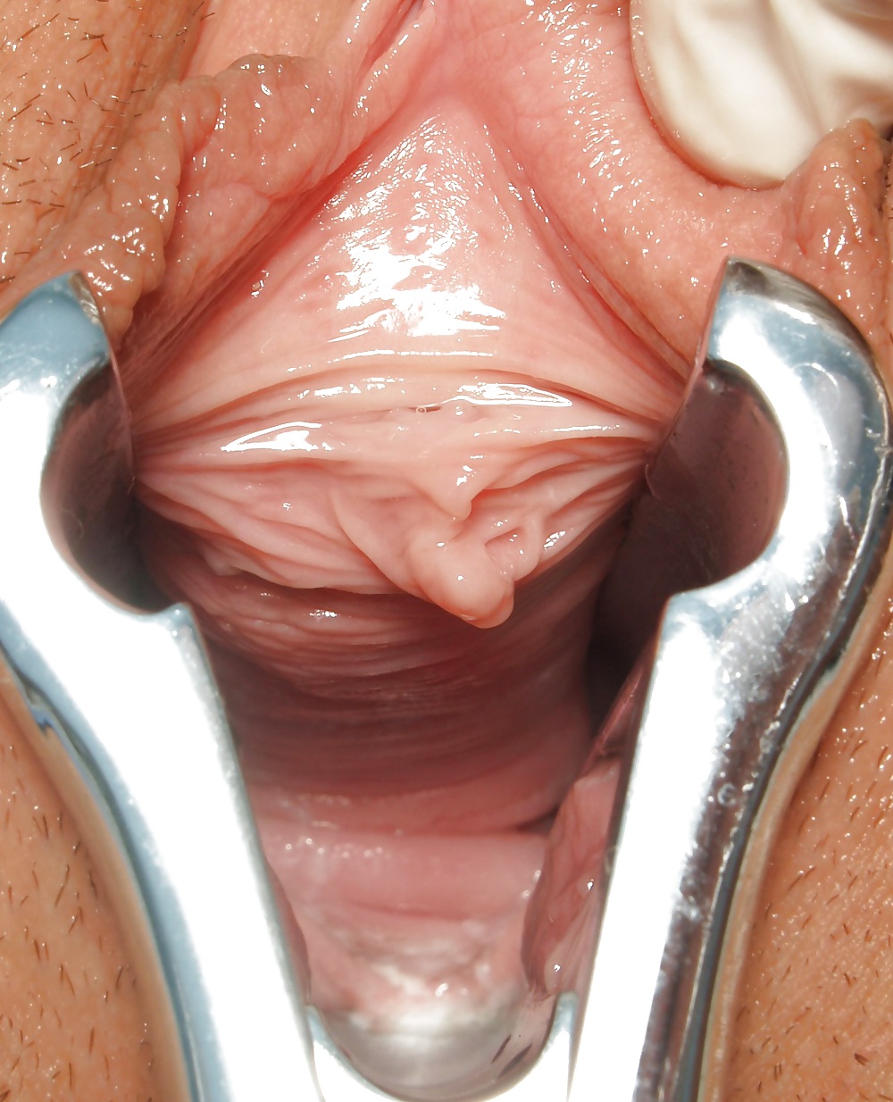 Speculum View in a pussy #6424545