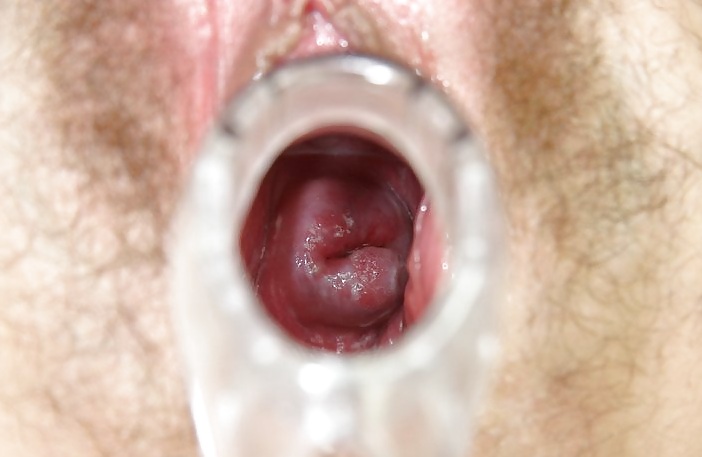 Speculum View in a pussy #6424549
