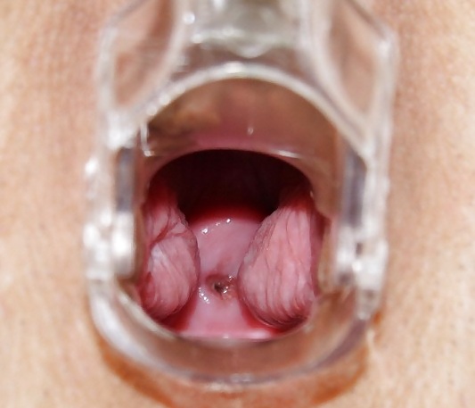 Speculum View in a pussy #6424562