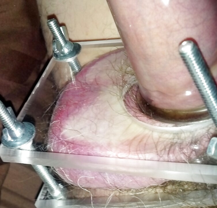 Pumpen & Brech #16833861