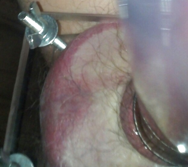 Pumping & Crushing #16833865