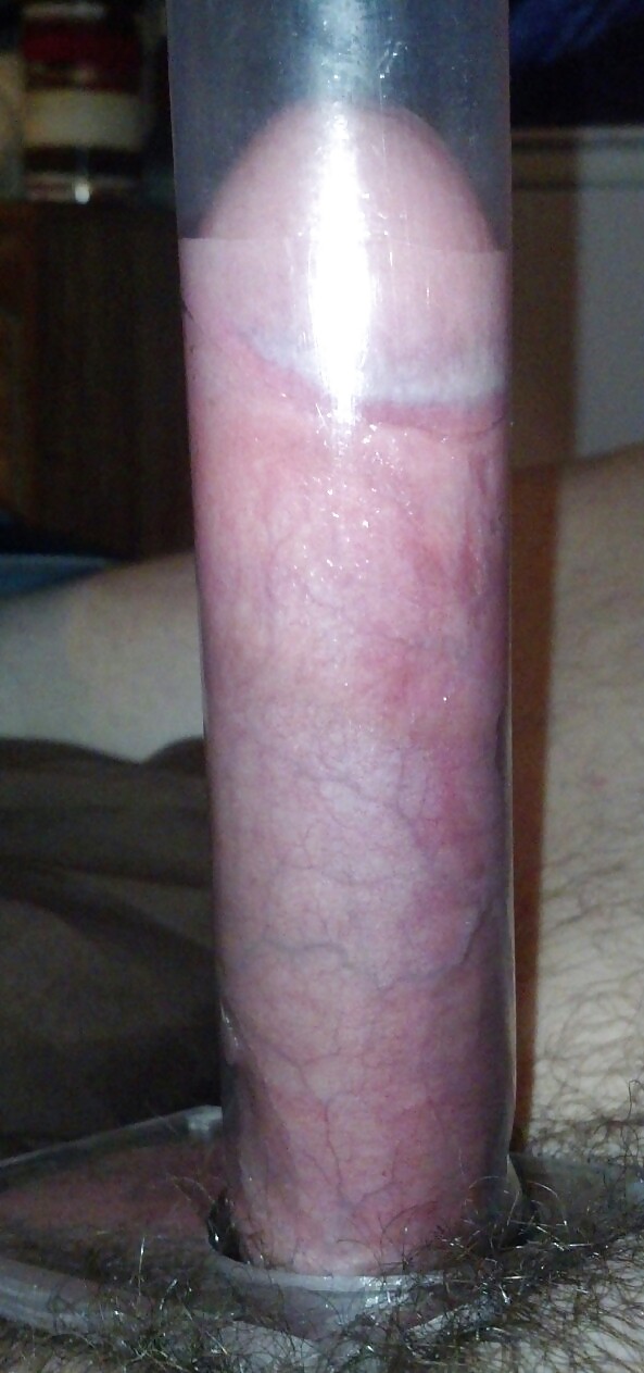 Pumpen & Brech #16833871