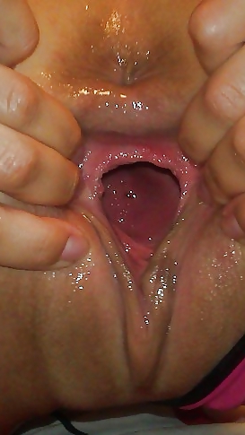 Xxx #17773409