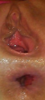 Xxx
 #17773417