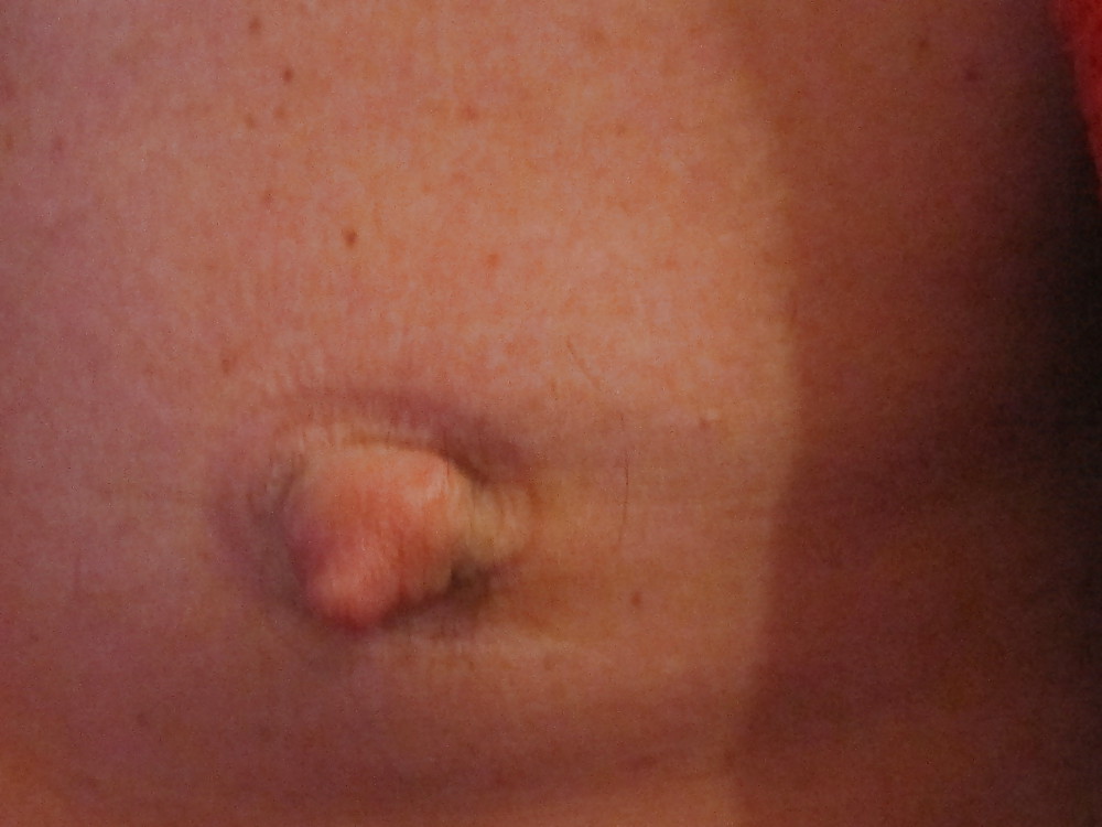 Moi #7466604