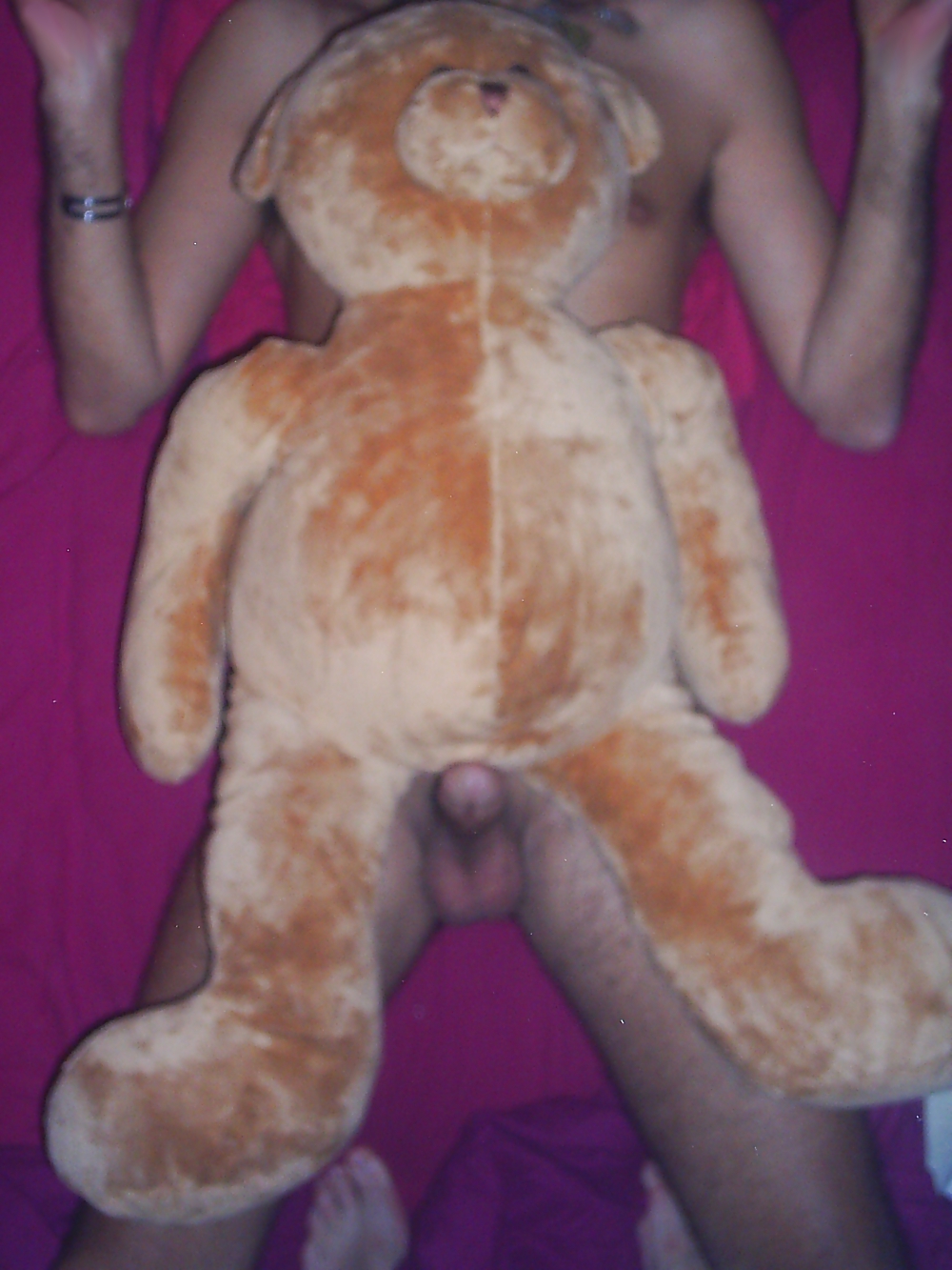 Me and my Teddy Undergo