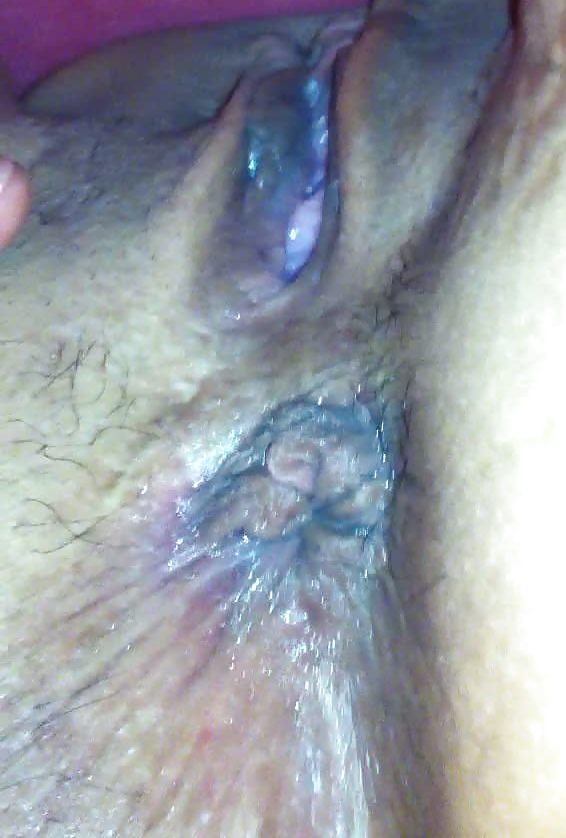 Wifes Asshole Closeup #5978481