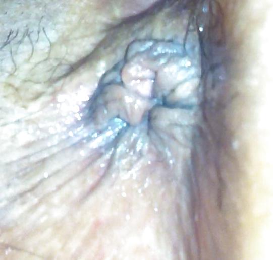 Wifes asshole closeup
 #5978501