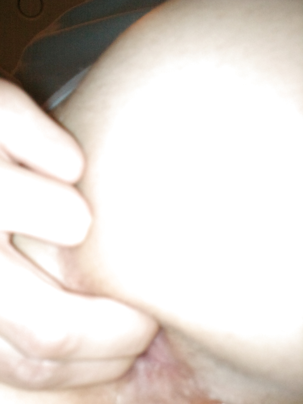 Rump=) #10030489