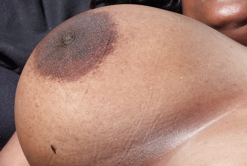 Parte exterior1
 #5772133