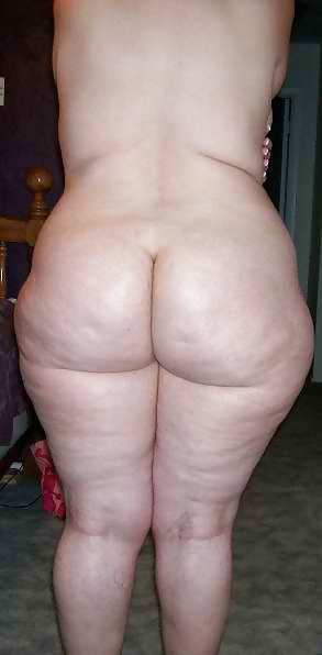 Cellulite 5 #9997500