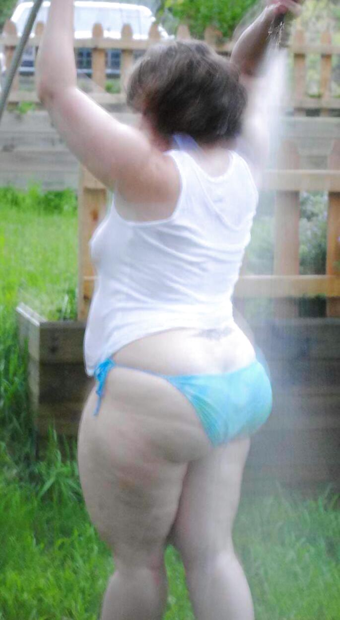 Cellulite 5 #9997540