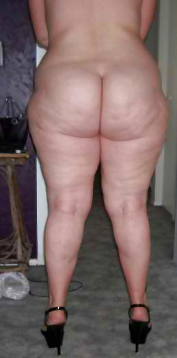 Cellulite 5 #9997621