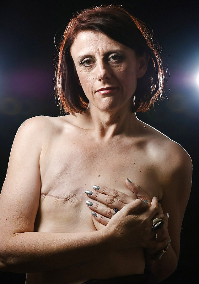 Amputado mastectomía discapacitados
 #20496820
