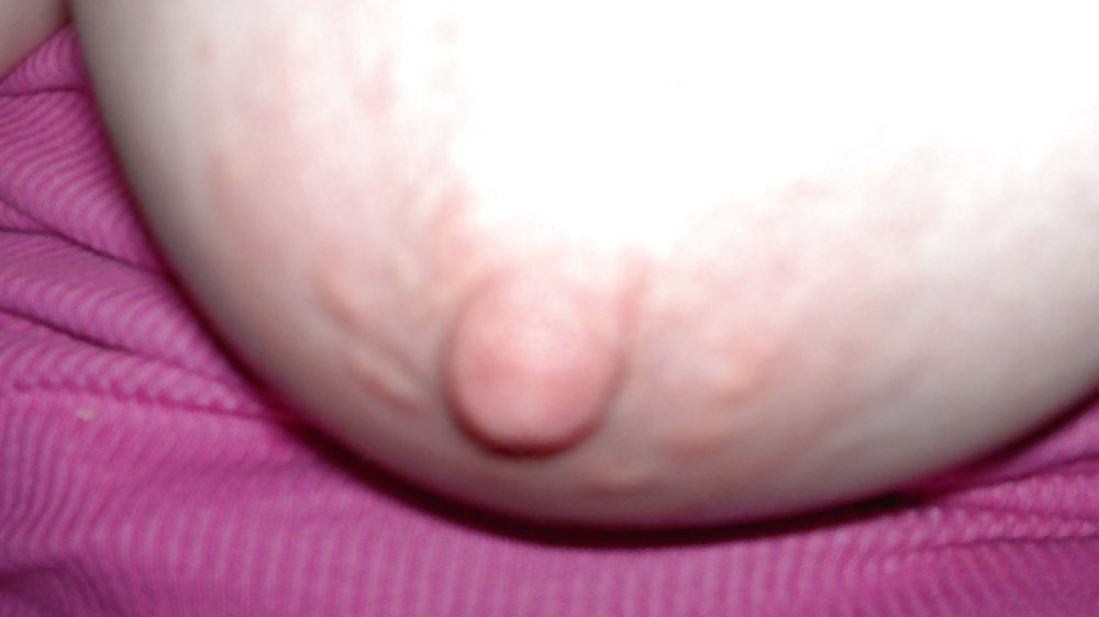Suckable? #8952156