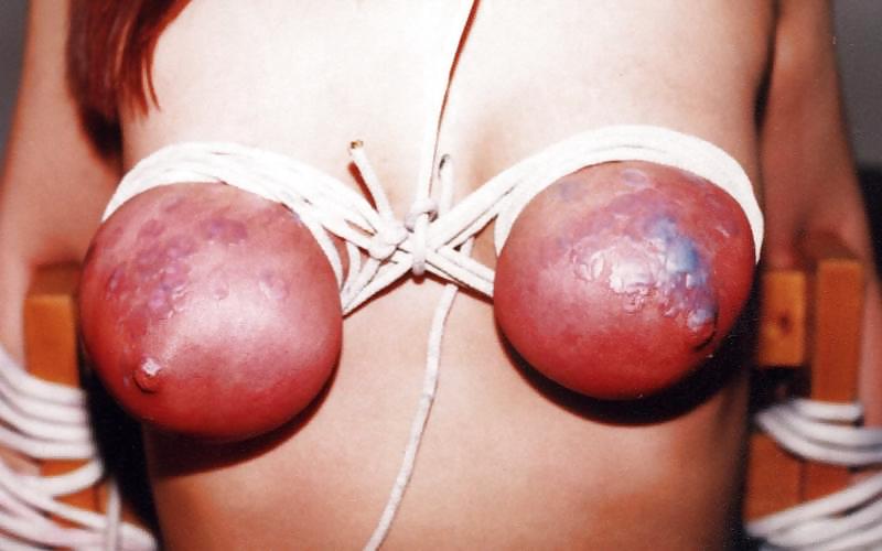 KEY - Tits tortured 4 of 4 #9453656