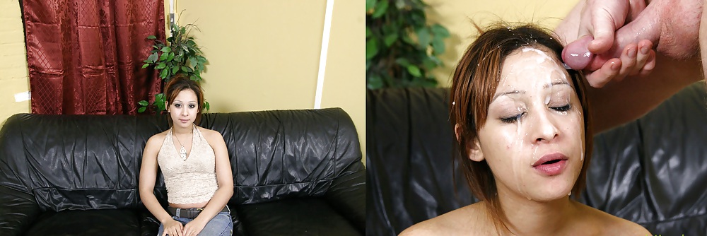 Prima e dopo il viso
 #11065673