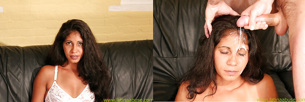 Prima e dopo il viso
 #11065703