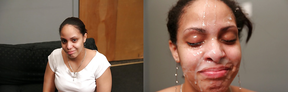 Before and After - Facials #11065955