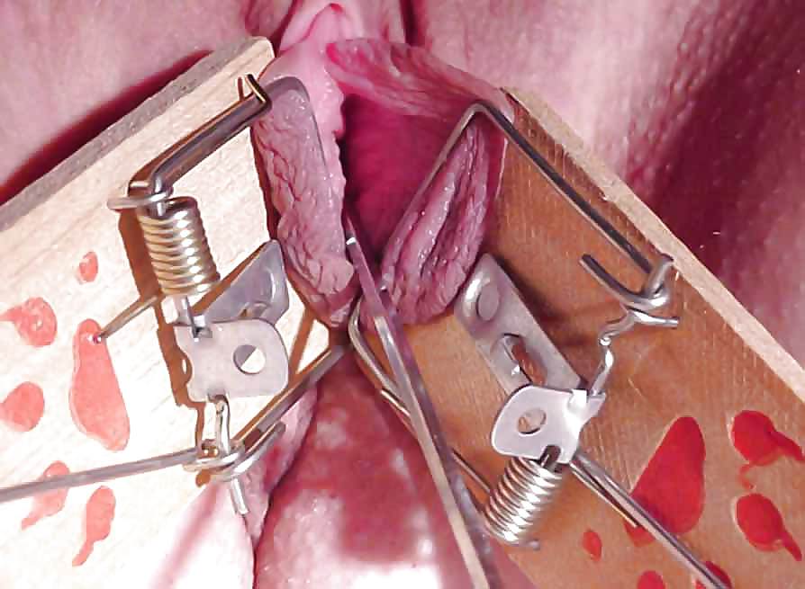 Clamped wide #9316093