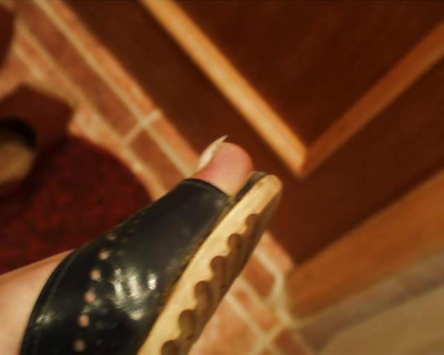 Long toenails 2003-01