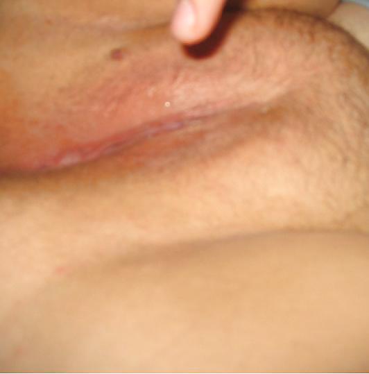 My ex-gf #7589733