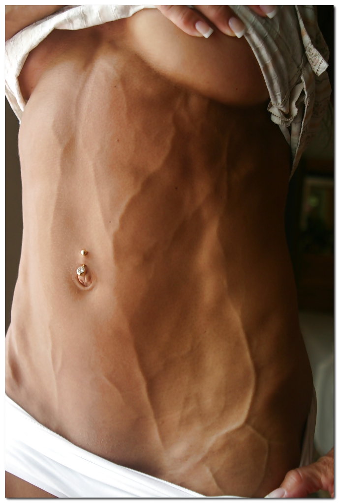 Veiny misc
 #13347718