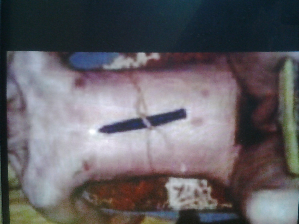 Lopette suiza encore punie
 #16066925