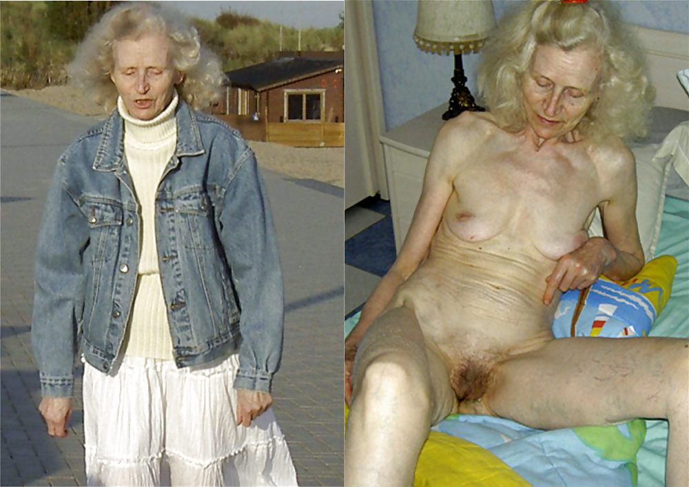 Before  after    josee   #4371542