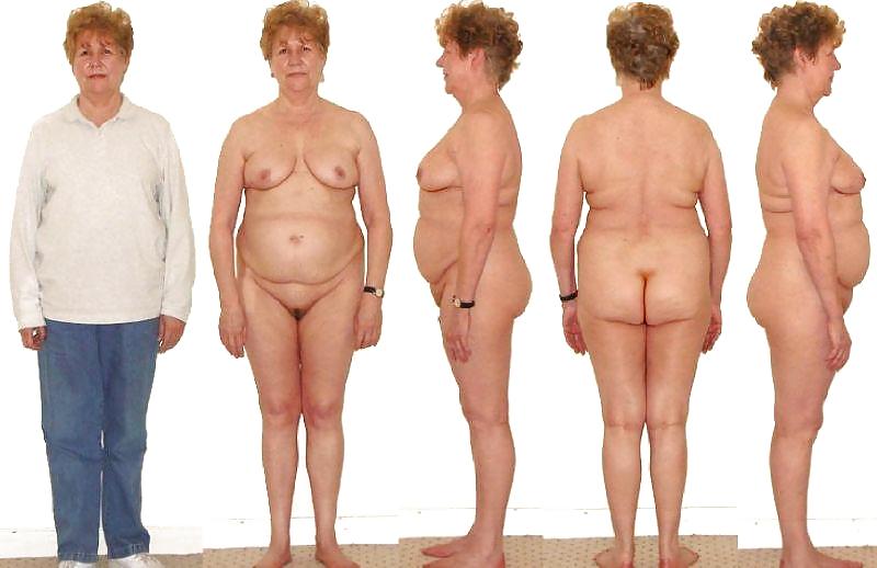 Before After 154. #2675013
