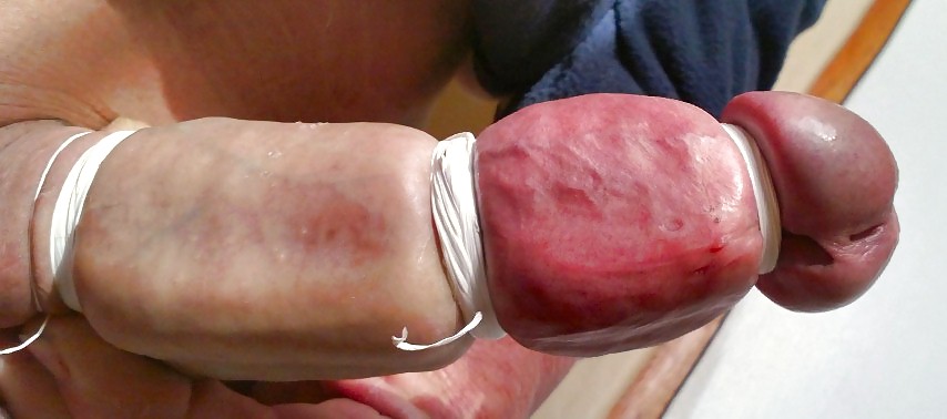 Bound differently  #19624235