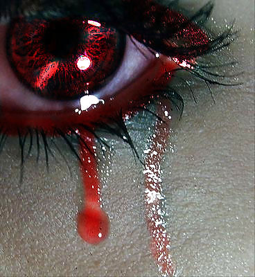 Broken heart