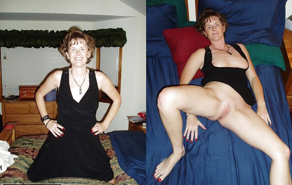 Before after 325. #3666827
