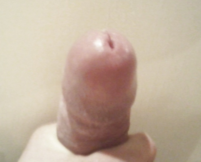 Mon gland